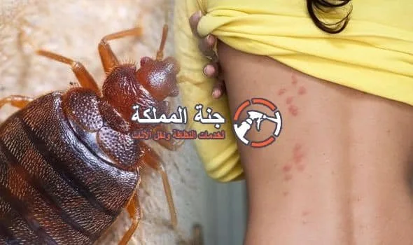 كيف اقضي على حشرة البق