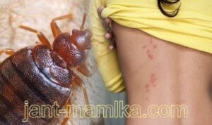 طرق طبيعية للتخلص من البق نهائيأ في المنزل